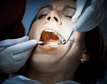 Zahnärztlicher Eingriff bei Frau