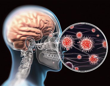 Symbolbild Meningokokken