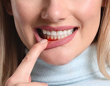 Frau mit gesunden Zähnen