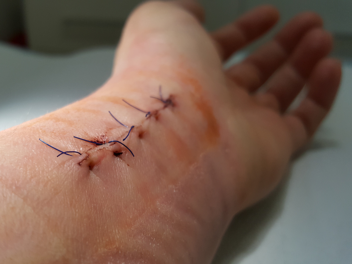 Postoperative Behandlung